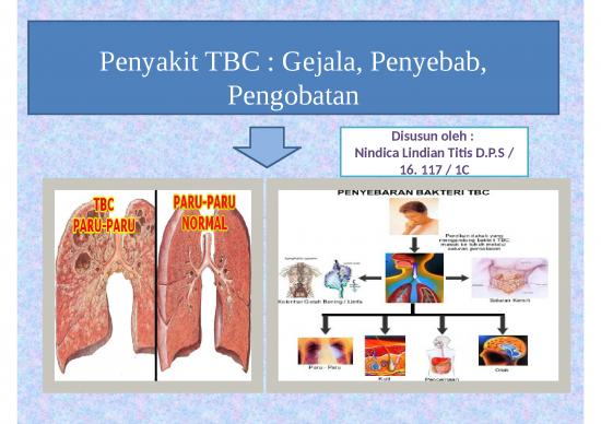 picture1_Penyakit Menular Umumnya Bersifat 2696 | Penyakit Tbc - Gejala Penyebab Pengobatan