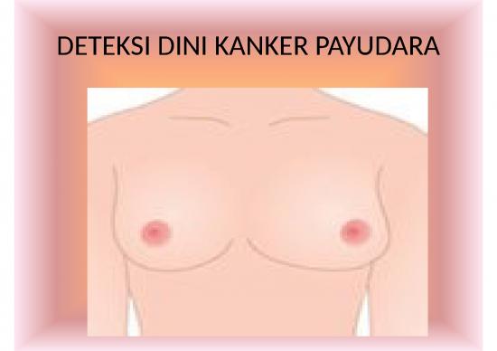 picture_Deteksi Dini Kanker Payudara