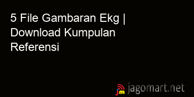 picture 5 File Gambaran Ekg | Download Kumpulan Referensi