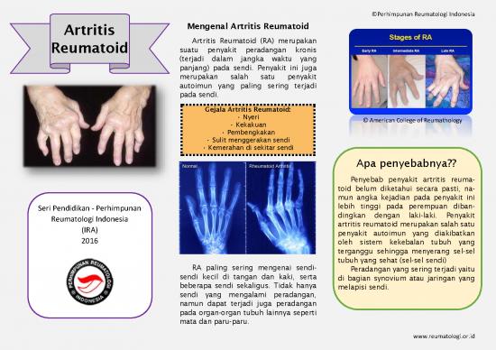 picture_Rheumatoid Arthritis
