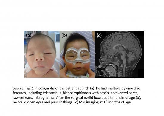 picture Analysis Ppt Repost 77662 | Mmc1 Item Download 2022-09-03 06-57-02