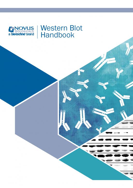 picture1_Western Blot Pdf 85794 | Br Westernblotguide 042816b