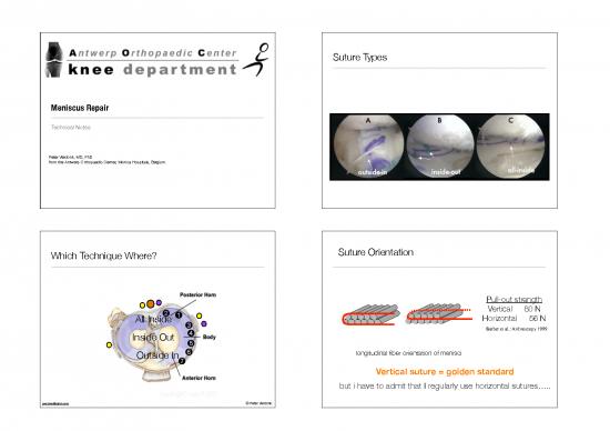 picture Types Of Sutures Pdf 87111 | Verdonkreparationsmeniscalesbr