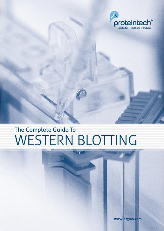 picture_Western Blot Pdf 87031 | Western Blot Protocol By Proteintech