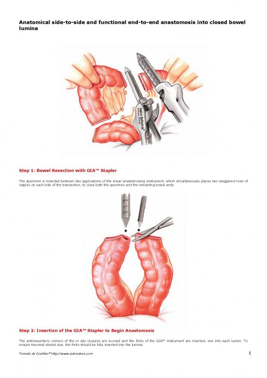 picture1_Anastomosis Intestinal