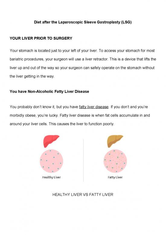 picture1_Diet After Gastric Sleeve Surgery Pdf 140644 | Diet After Lsg
